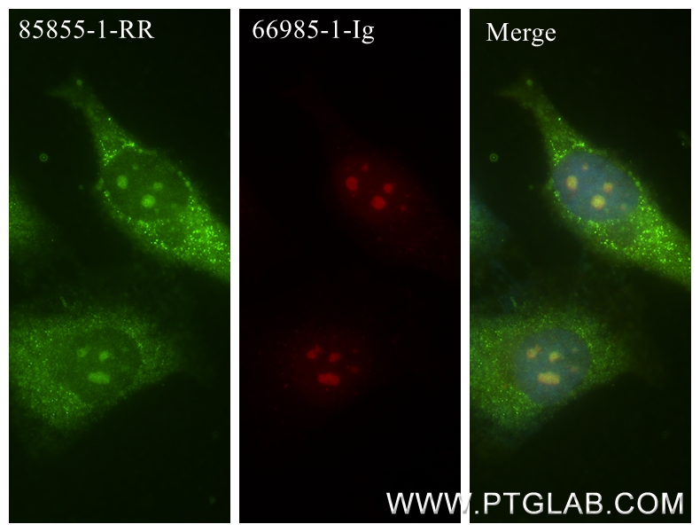 IF Staining of HeLa using 85855-1-RR