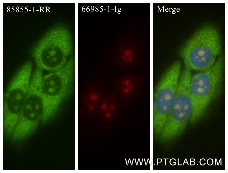 IF Staining of HepG2 using 85855-1-RR