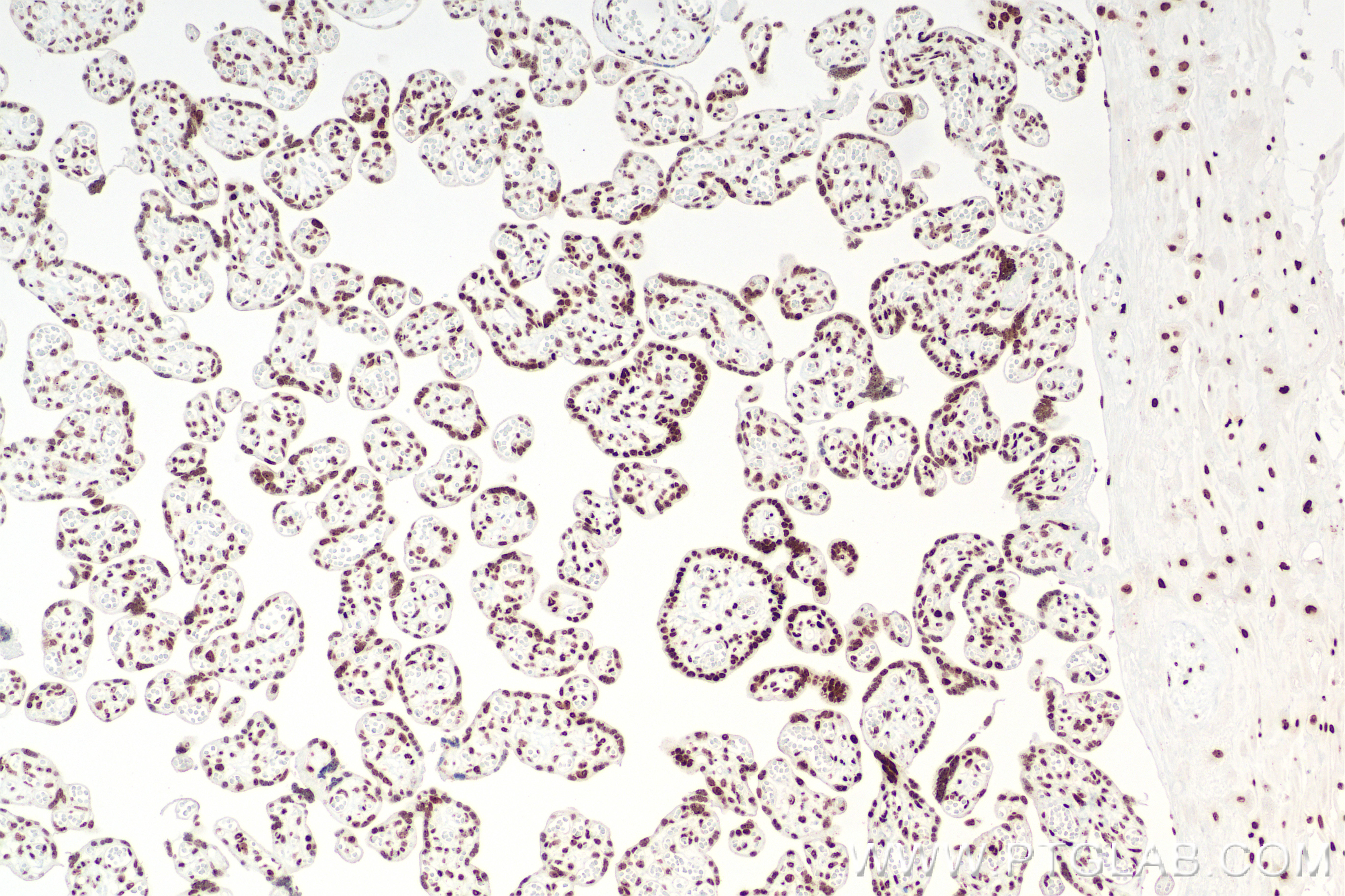 IHC staining of human placenta using 85855-1-RR