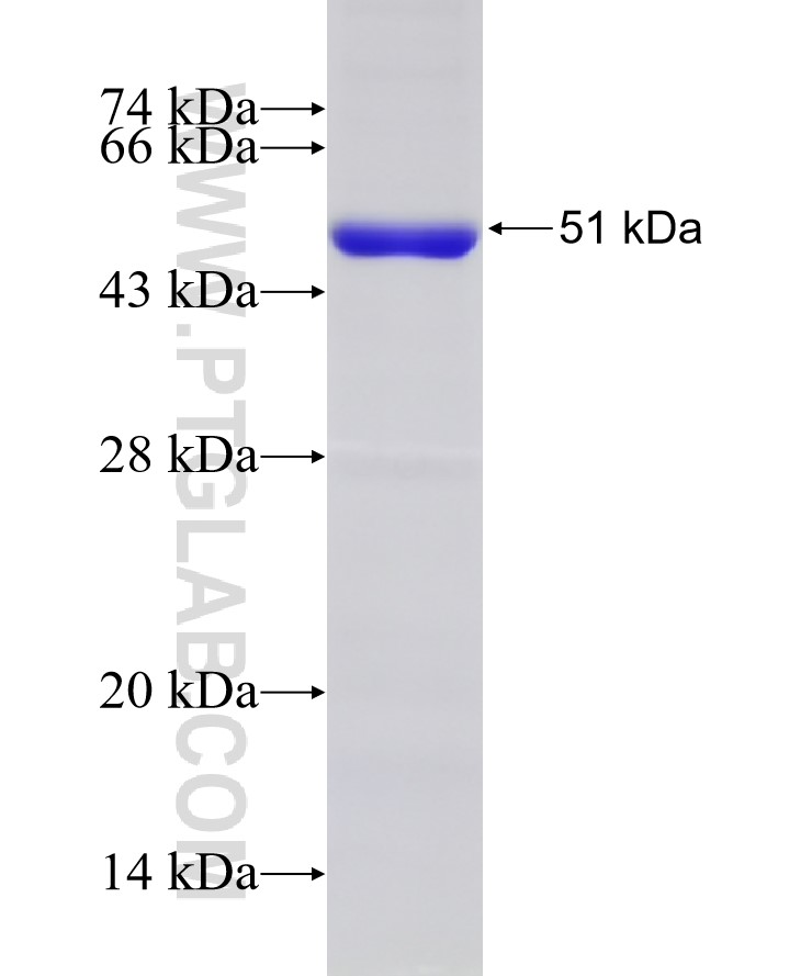 DNA2 fusion protein Ag17119 SDS-PAGE