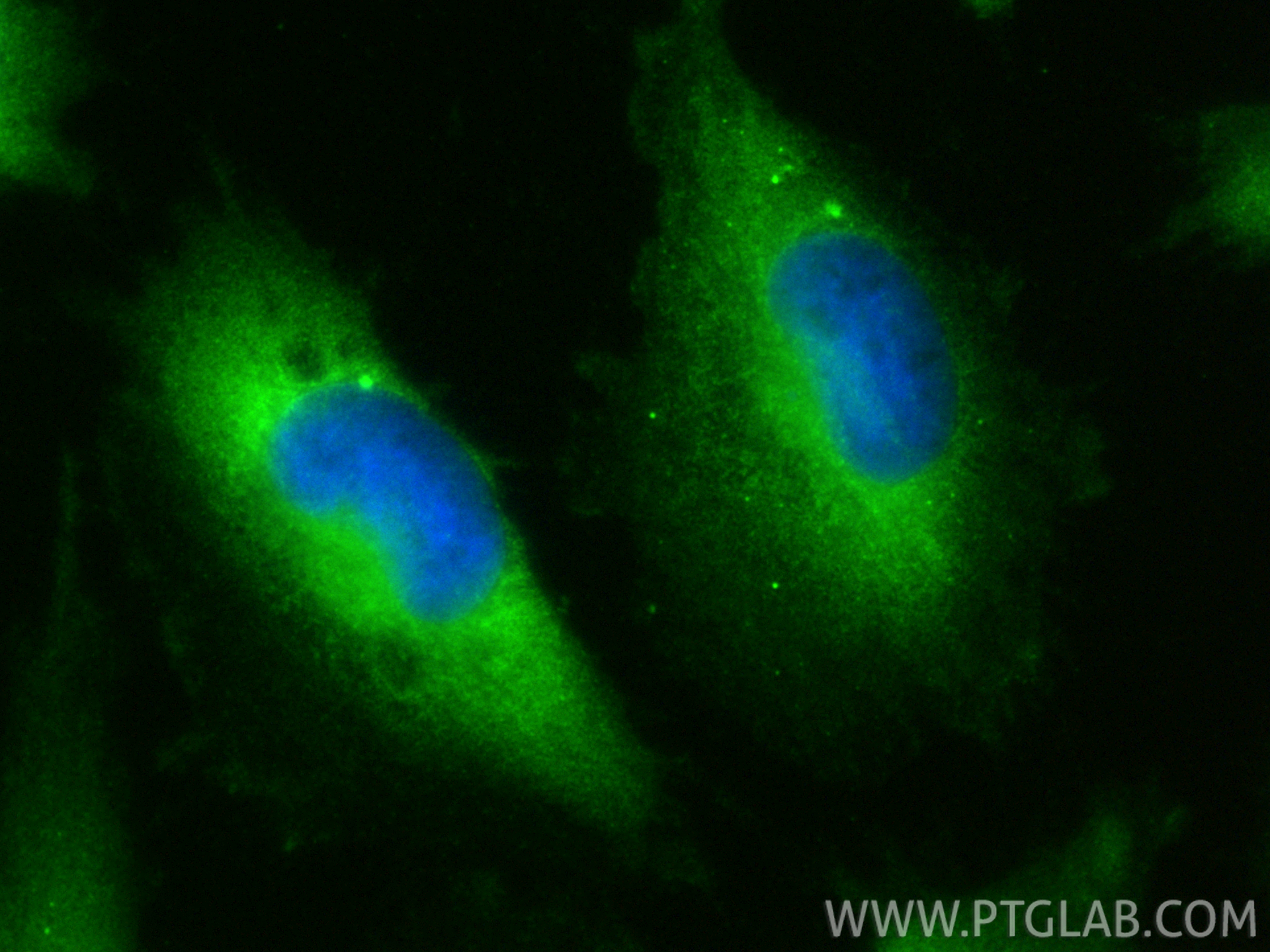 IF Staining of U-251 using 23228-1-AP (same clone as 23228-1-PBS) IF Staining of U-251 using 23228-1-AP (same clone as 23228-1-PBS)