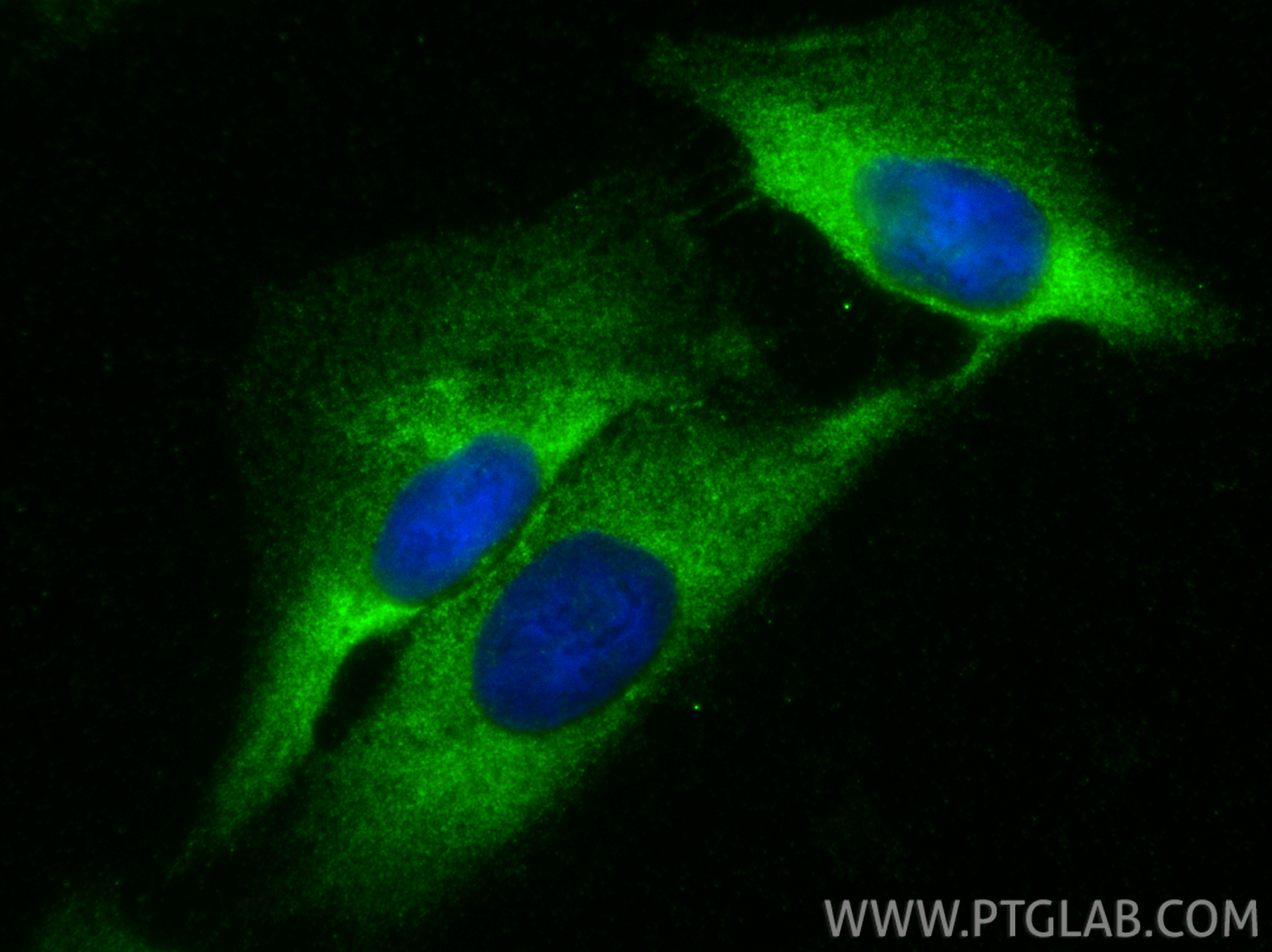 IF Staining of U2OS using 23228-1-AP (same clone as 23228-1-PBS) IF Staining of U2OS using 23228-1-AP (same clone as 23228-1-PBS)