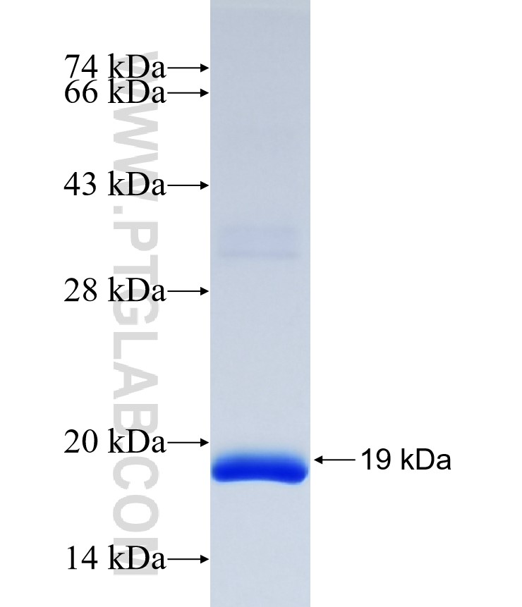 DNAH10 fusion protein Ag37015 SDS-PAGE