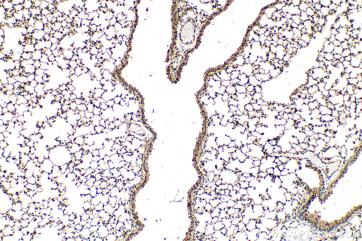 IHC staining of mouse lung using 31281-1-AP