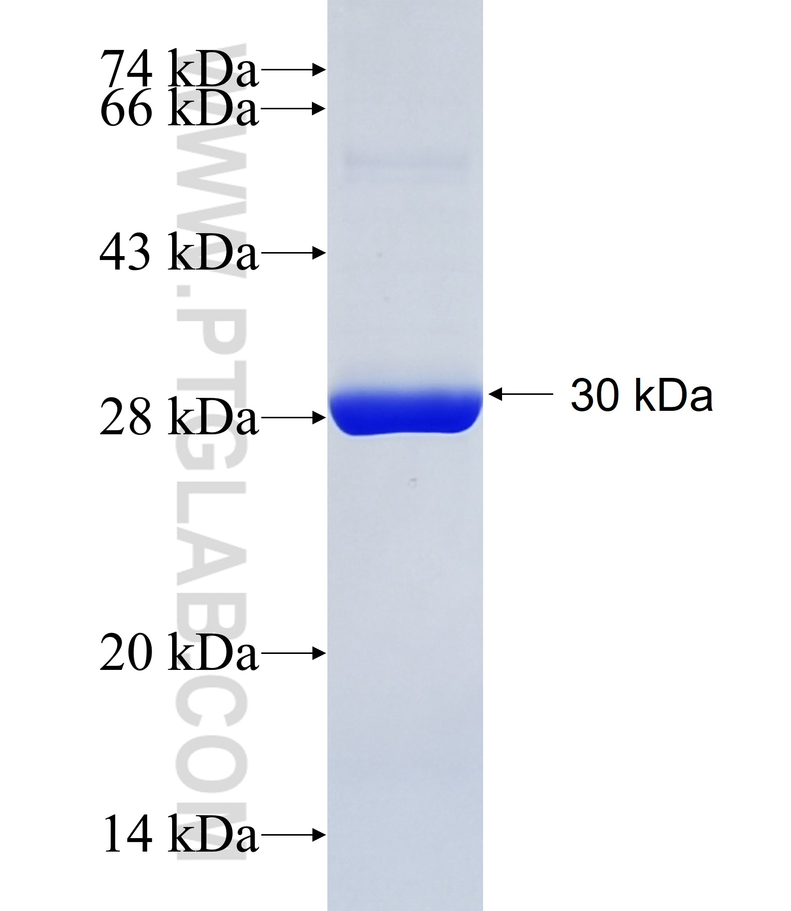 DNAH11 fusion protein Ag34705 SDS-PAGE DNAH11 fusion protein Ag34705 SDS-PAGE