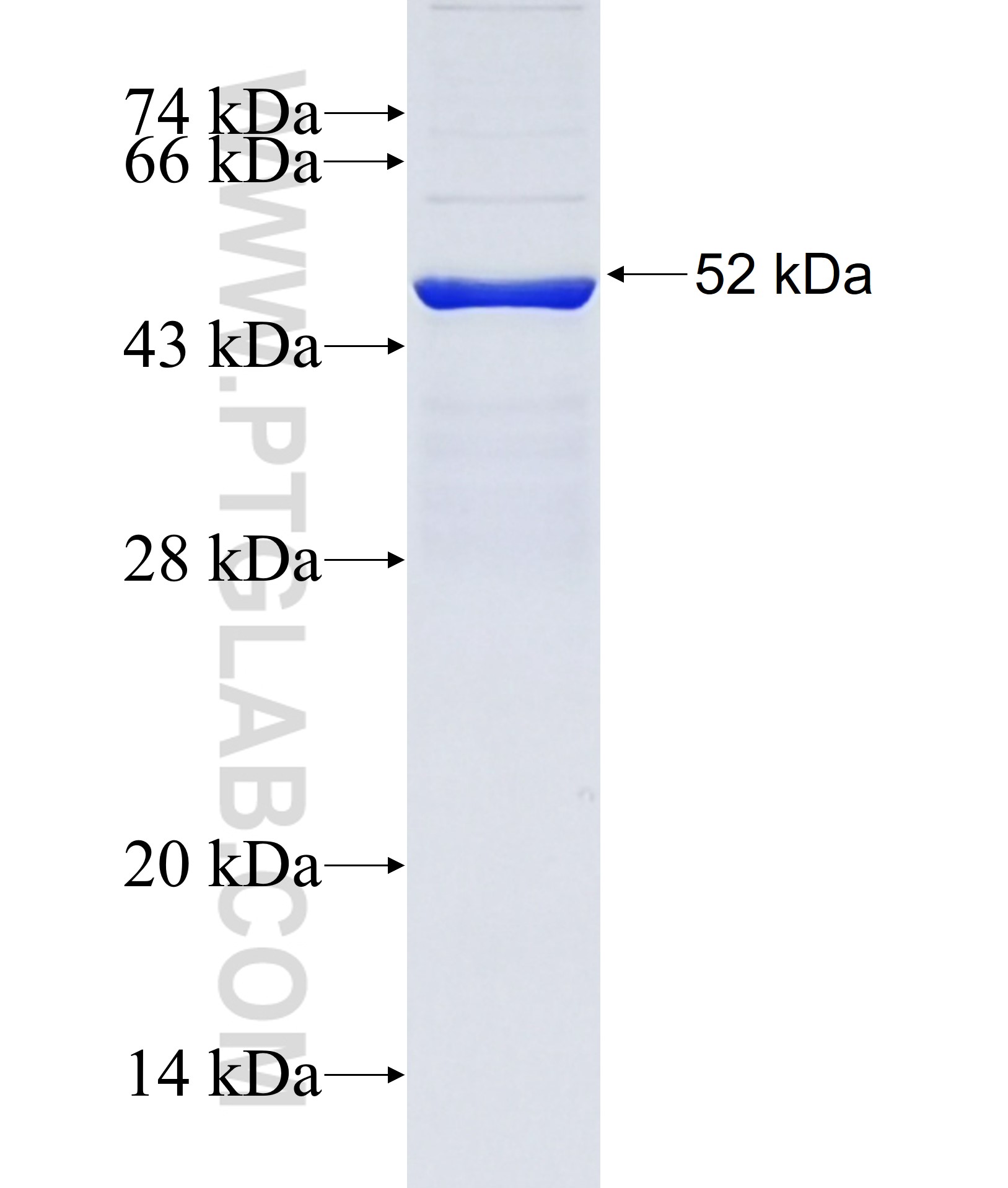 DNAH12 fusion protein Ag38008 SDS-PAGE DNAH12 fusion protein Ag38008 SDS-PAGE