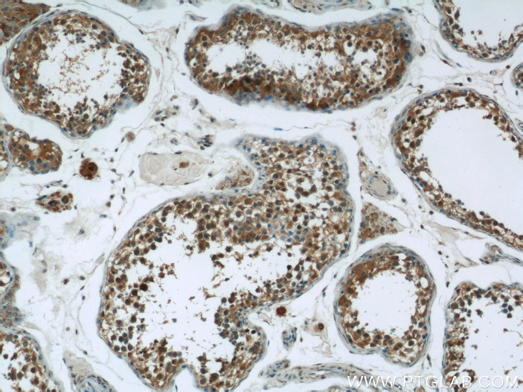 IHC staining of human testis using 25072-1-AP