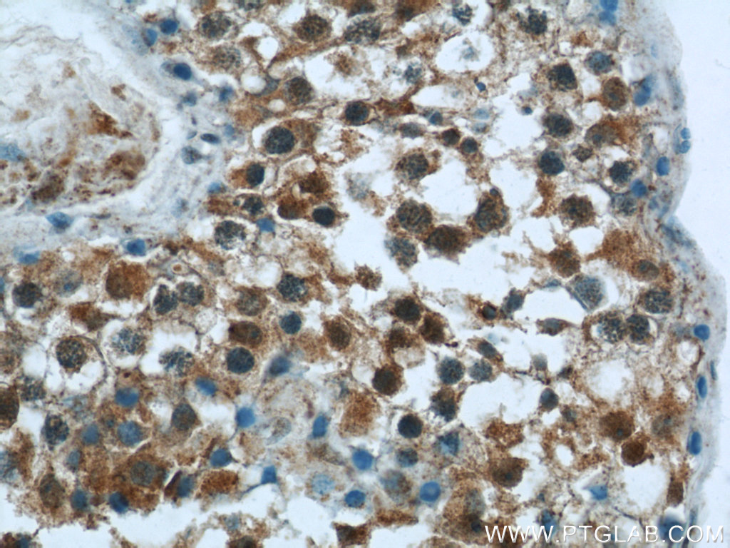 IHC staining of human testis using 25072-1-AP