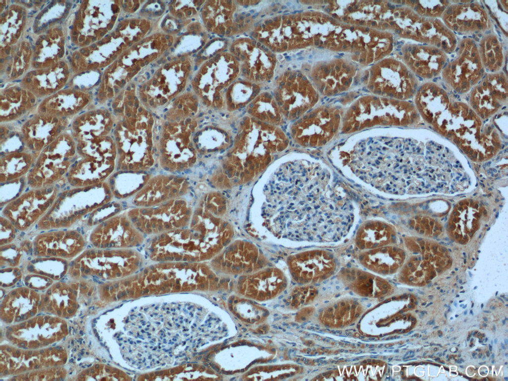 IHC staining of human kidney using 24488-1-AP