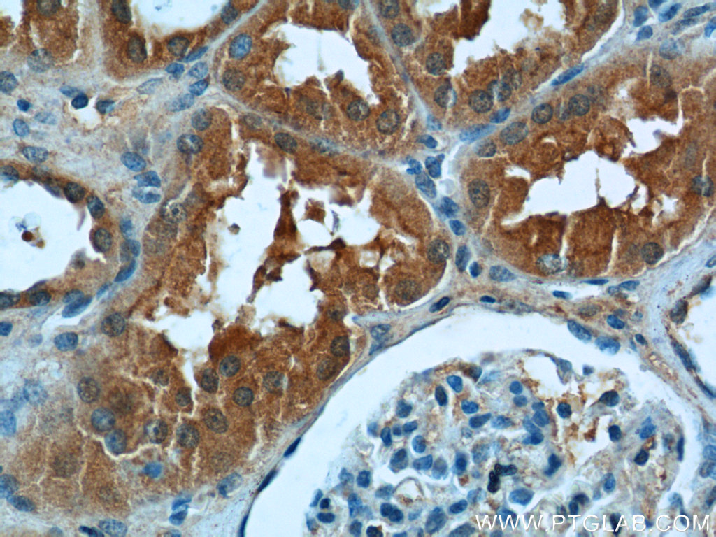 IHC staining of human kidney using 24488-1-AP