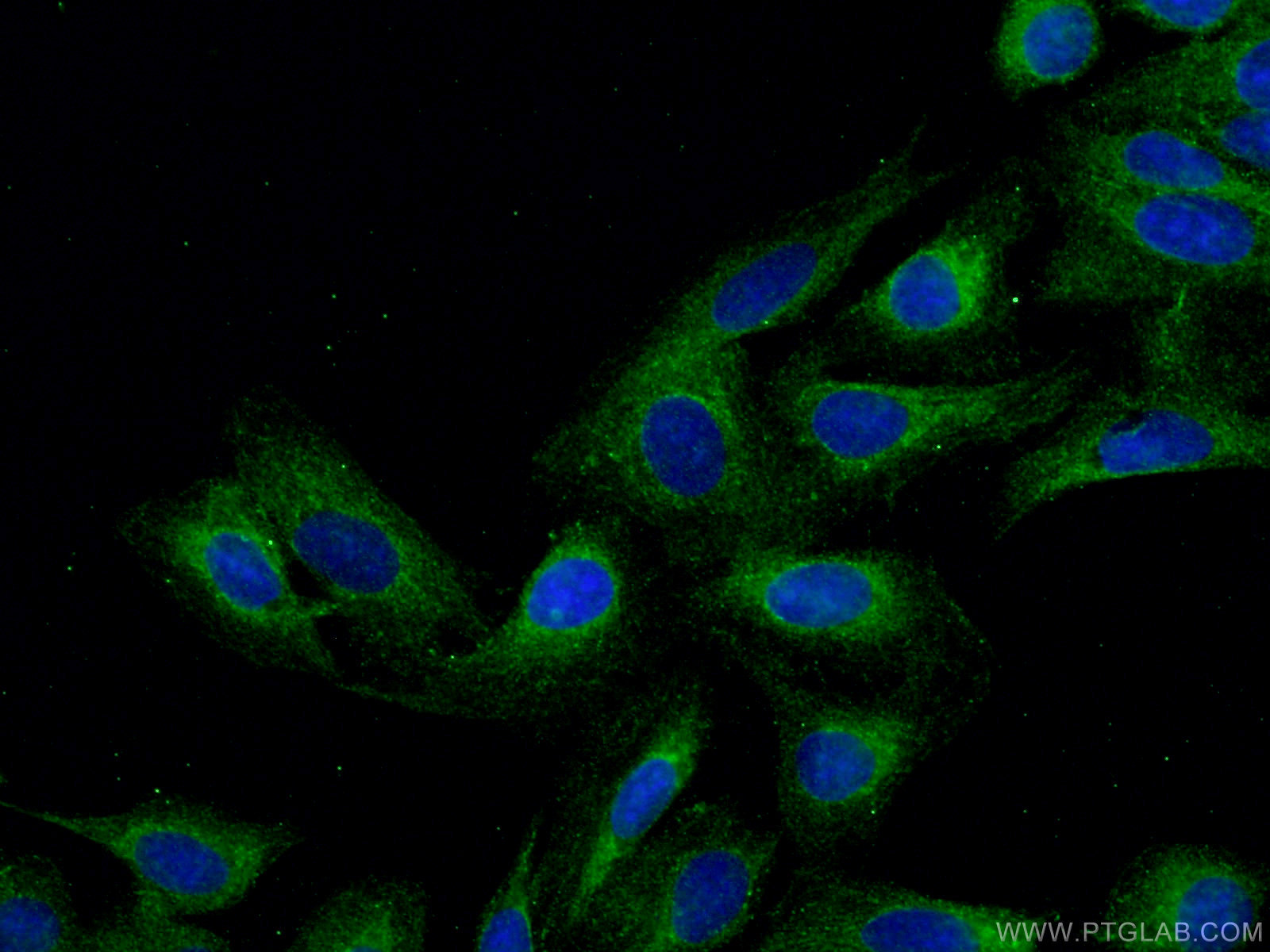 IF Staining of U2OS using 18841-1-AP