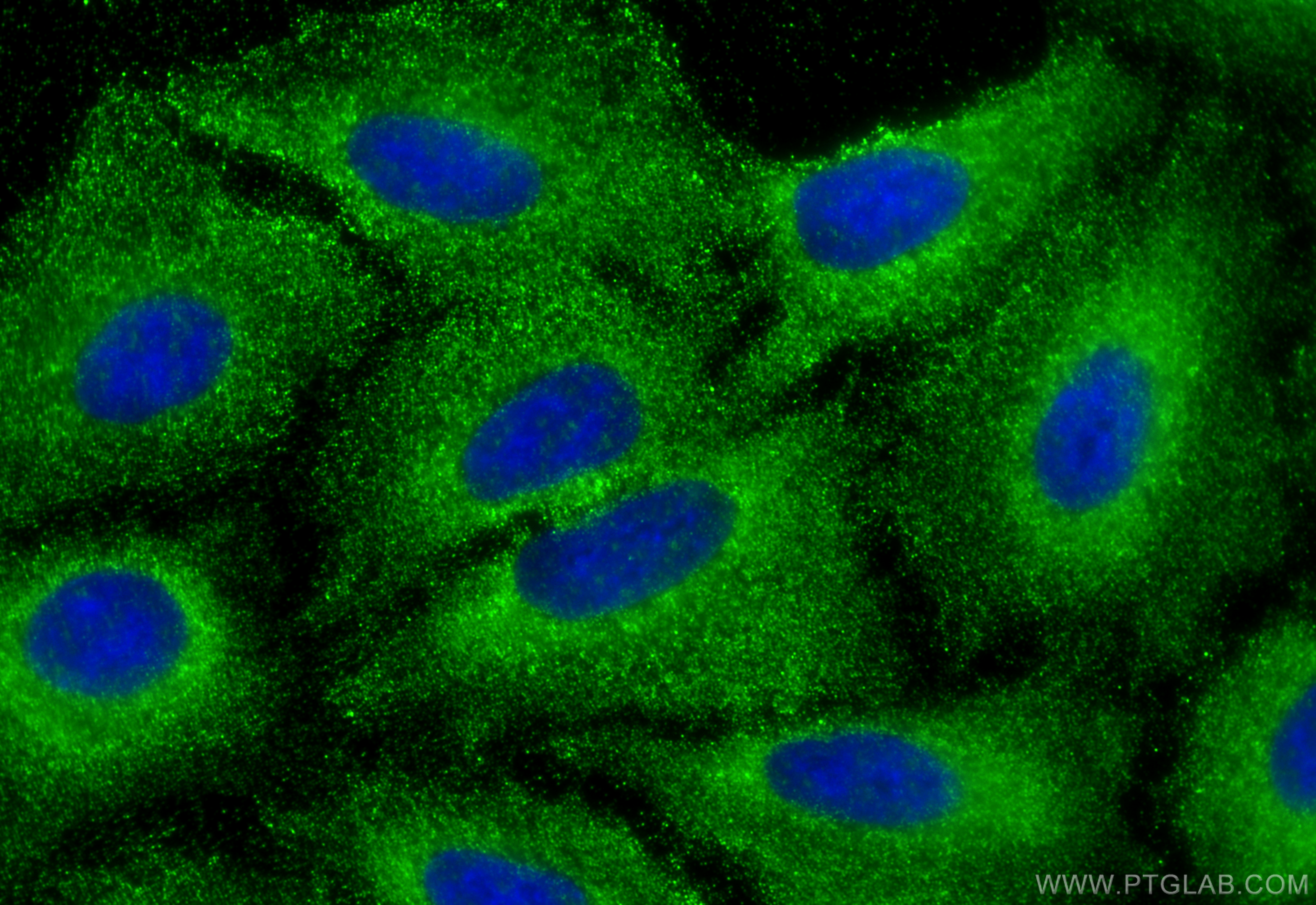 IF Staining of A549 using 18841-1-AP