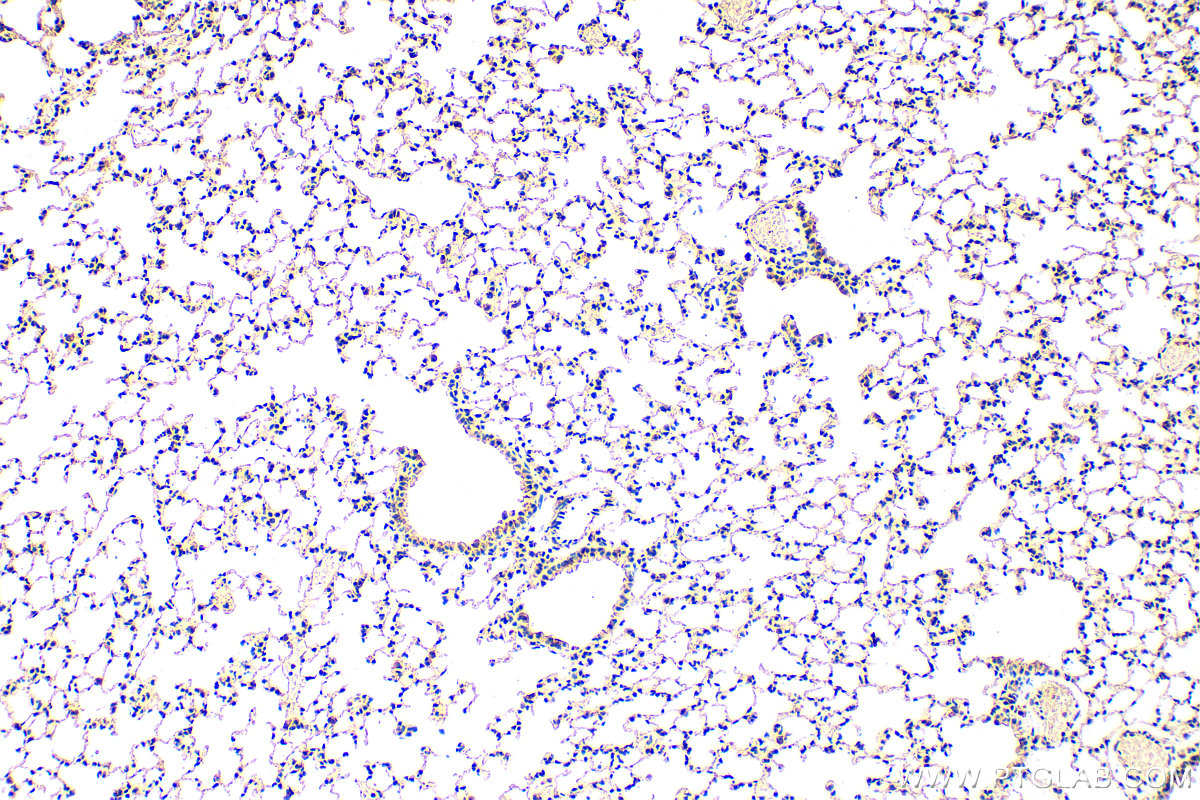 IHC staining of mouse lung using 31079-1-AP