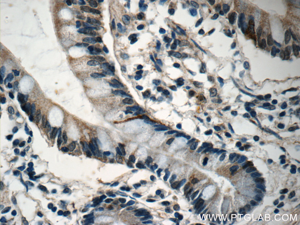 IHC staining of human small intestine using 18080-1-AP