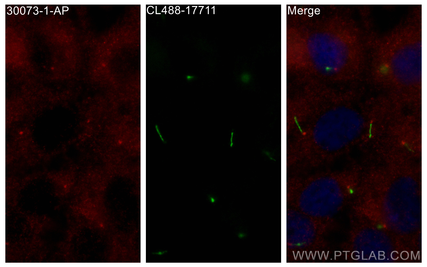 IF Staining of hTERT-RPE1 using 30073-1-AP