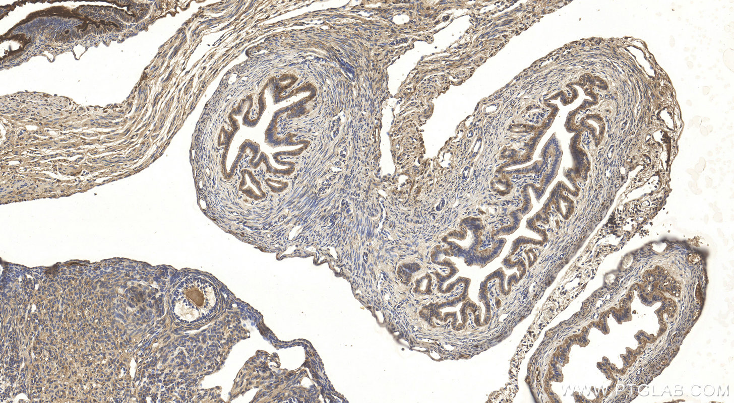 IHC staining of mouse ovary using 17533-1-AP