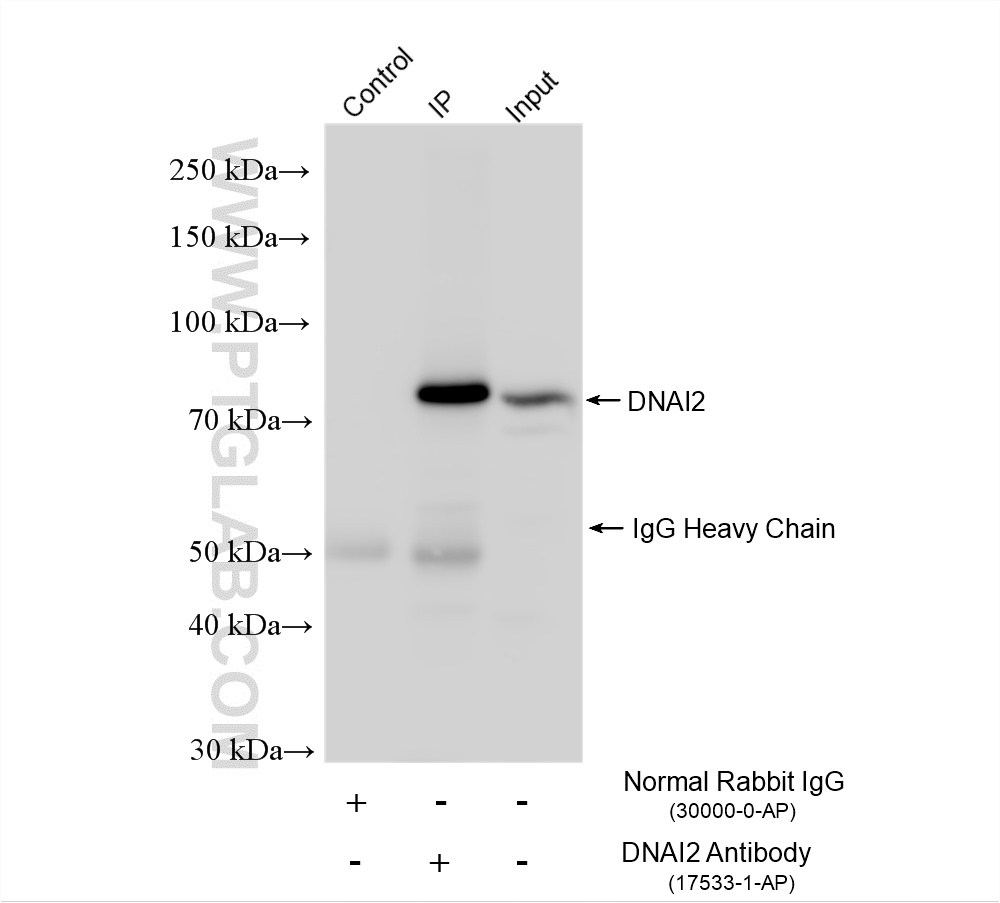 IP result of anti-DNAI2 (IP:17533-1-AP, 4ug; Detection:17533-1-AP 1:1000) with mouse testis tissue lysate 1520 ug. IP experiment of mouse testis using 17533-1-AP