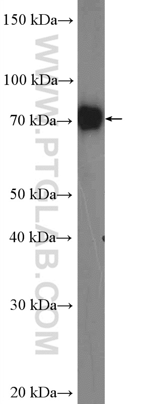 WB analysis of mouse ovary using 17533-1-AP