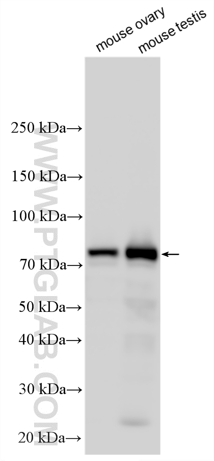 Various lysates were subjected to SDS PAGE followed by western blot with 17533-1-AP (DNAI2 antibody) at dilution of 1:2000 incubated at room temperature for 1.5 hours. WB analysis using 17533-1-AP