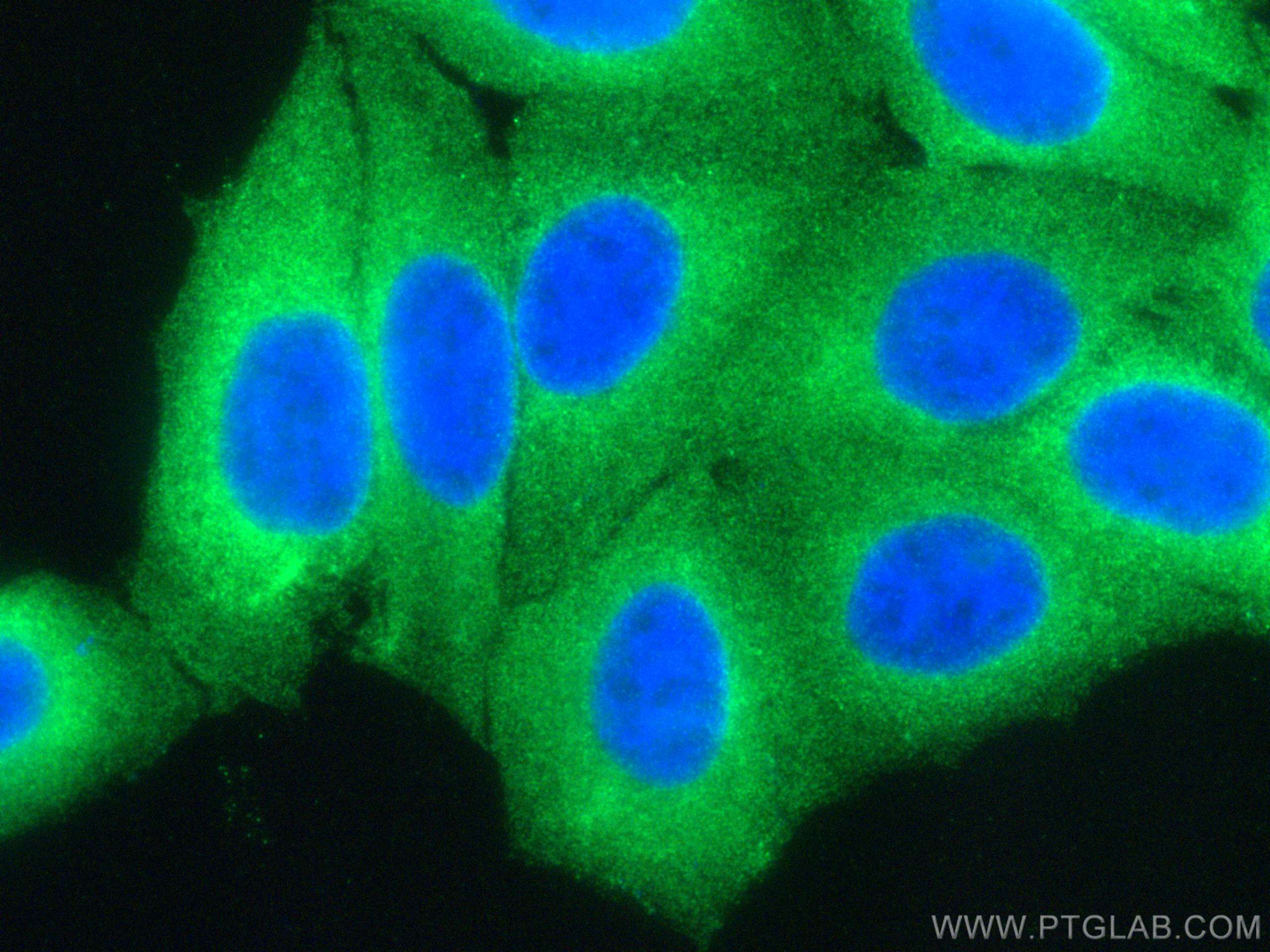 IF Staining of HepG2 using 67184-1-Ig (same clone as 67184-1-PBS)