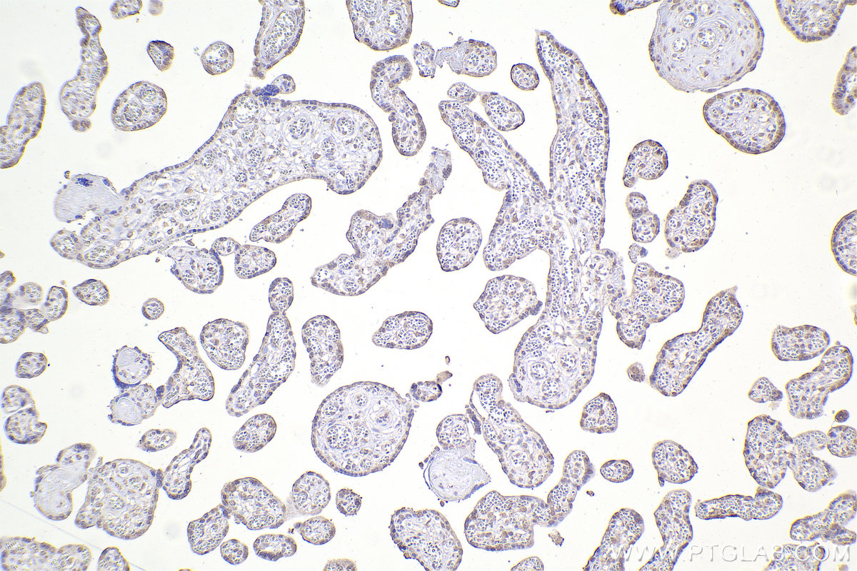IHC staining of human placenta using 67184-1-Ig (same clone as 67184-1-PBS)