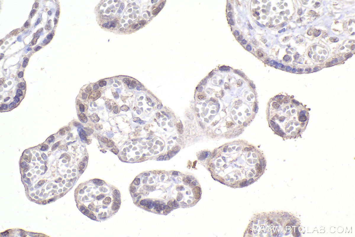 IHC staining of human placenta using 67184-1-Ig (same clone as 67184-1-PBS)