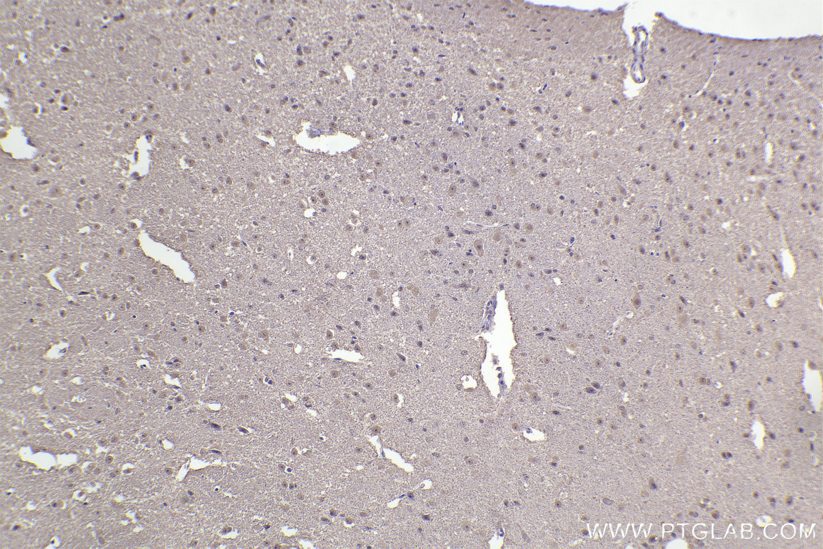 IHC staining of mouse brain using 67184-1-Ig (same clone as 67184-1-PBS)