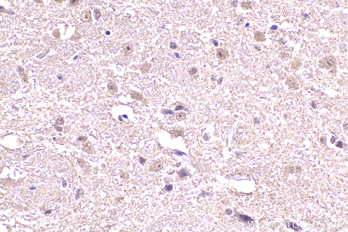IHC staining of mouse brain using 67184-1-Ig (same clone as 67184-1-PBS)