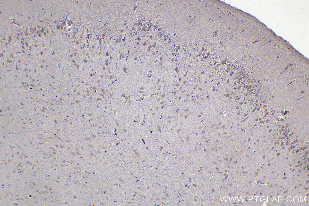 IHC staining of rat brain using 67184-1-Ig (same clone as 67184-1-PBS)