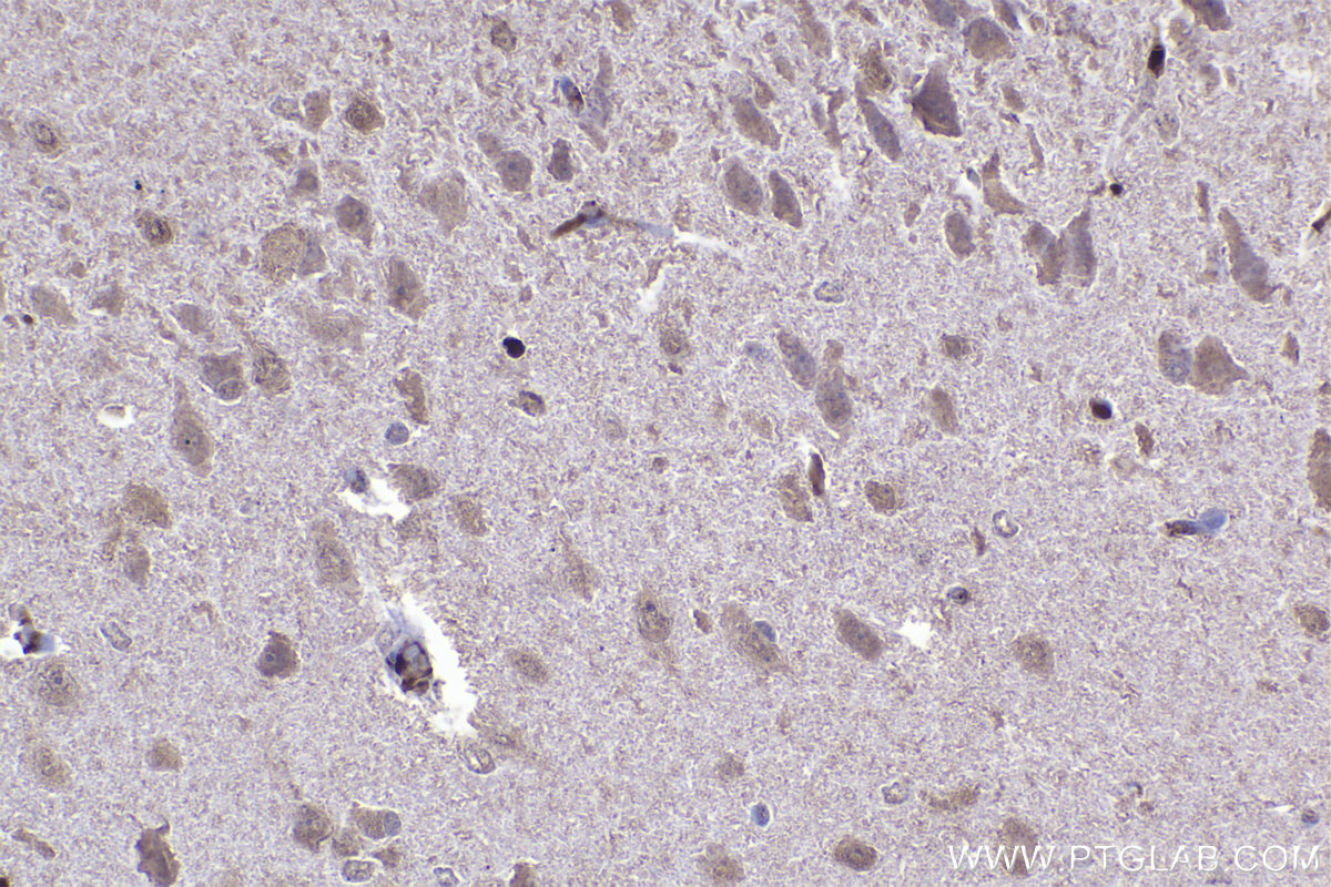 IHC staining of rat brain using 67184-1-Ig (same clone as 67184-1-PBS)