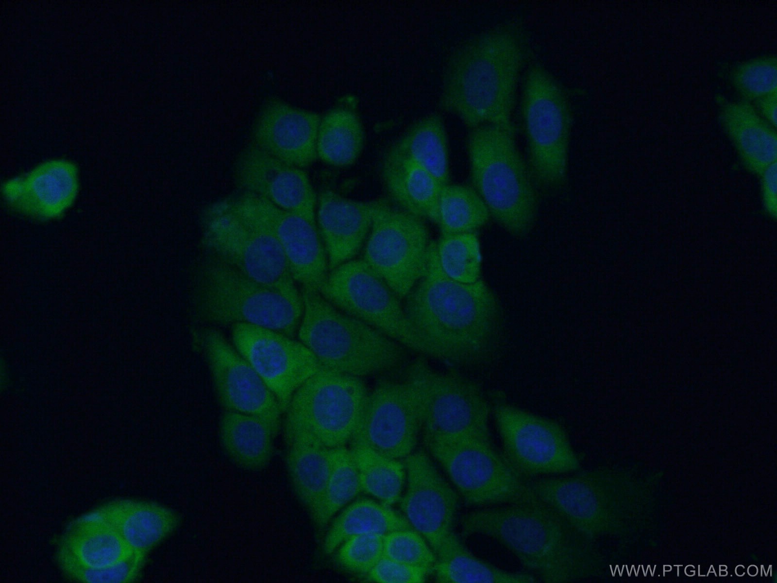IF Staining of MCF-7 using 12236-1-AP