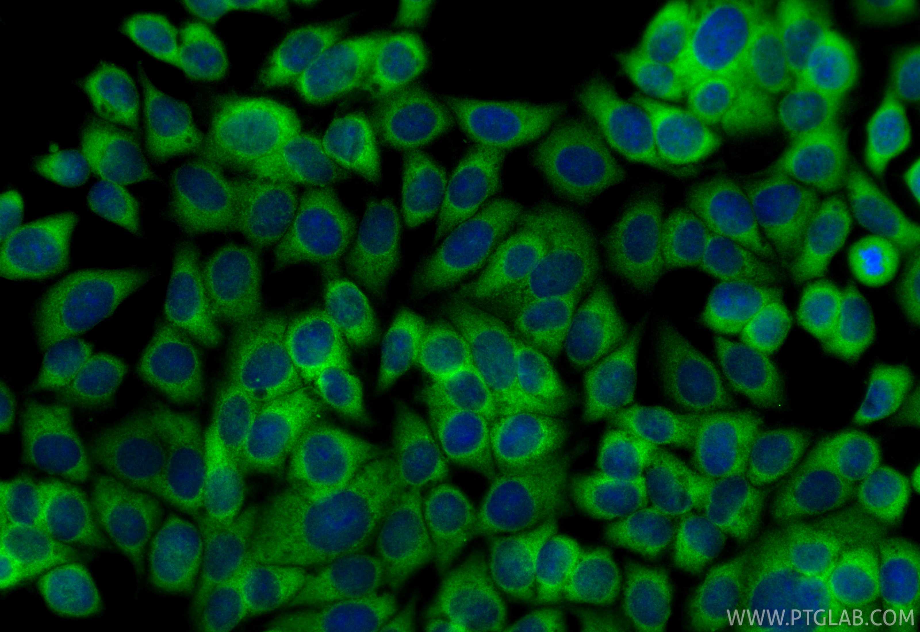 IF Staining of MCF-7 using 12236-1-AP