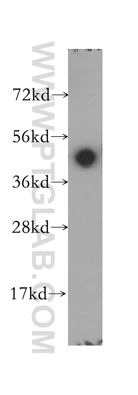 WB analysis of A375 using 12236-1-AP