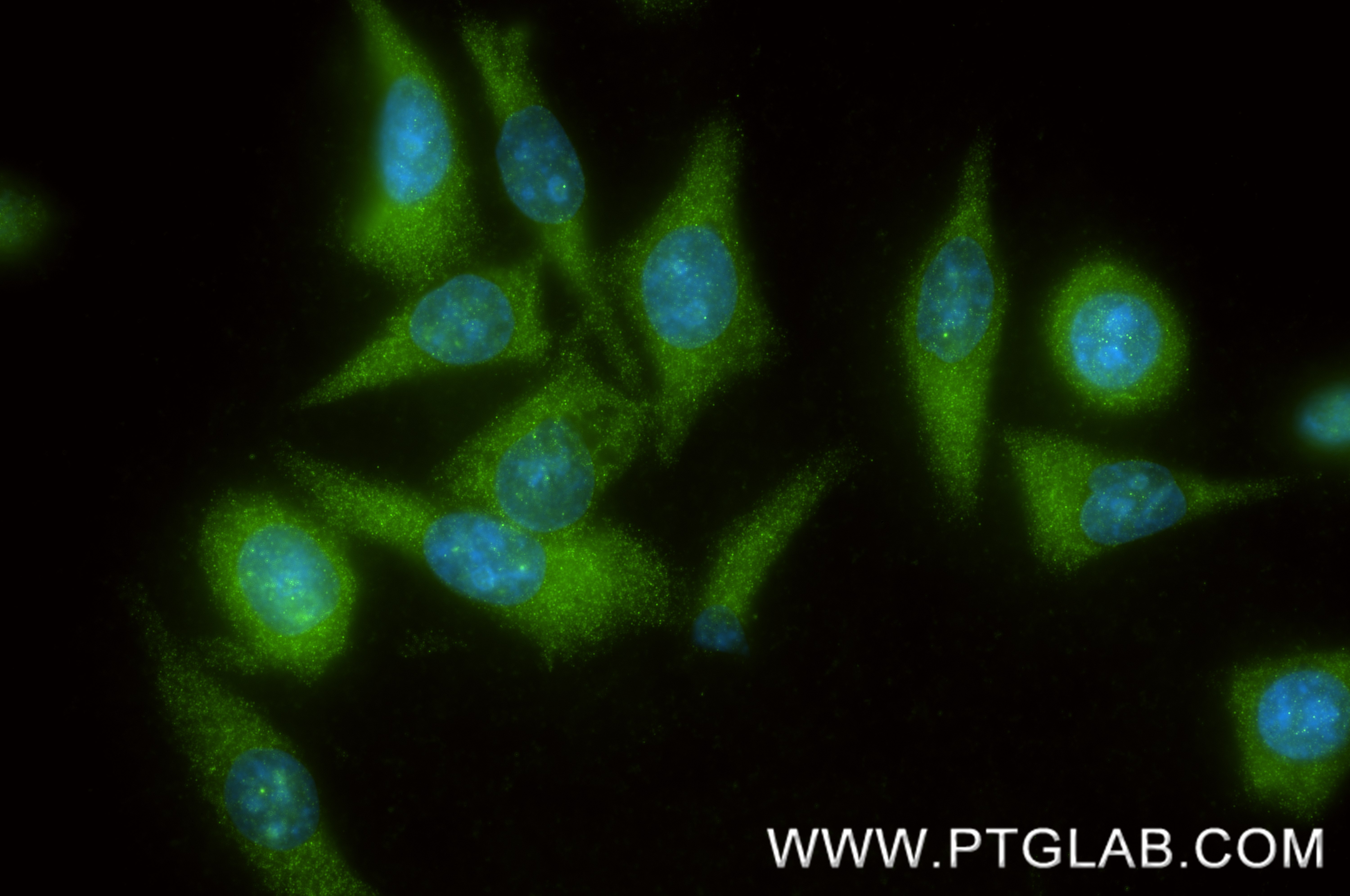 IF Staining of HepG2 using 87041-2-RR (same clone as 87041-2-PBS) IF Staining of HepG2 using 87041-2-RR (same clone as 87041-2-PBS)