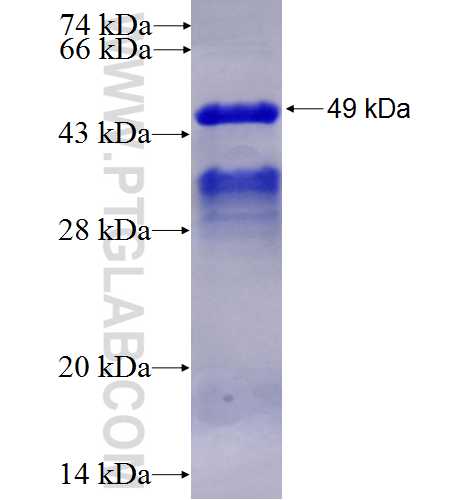 DNAJA2 fusion protein Ag2877 SDS-PAGE