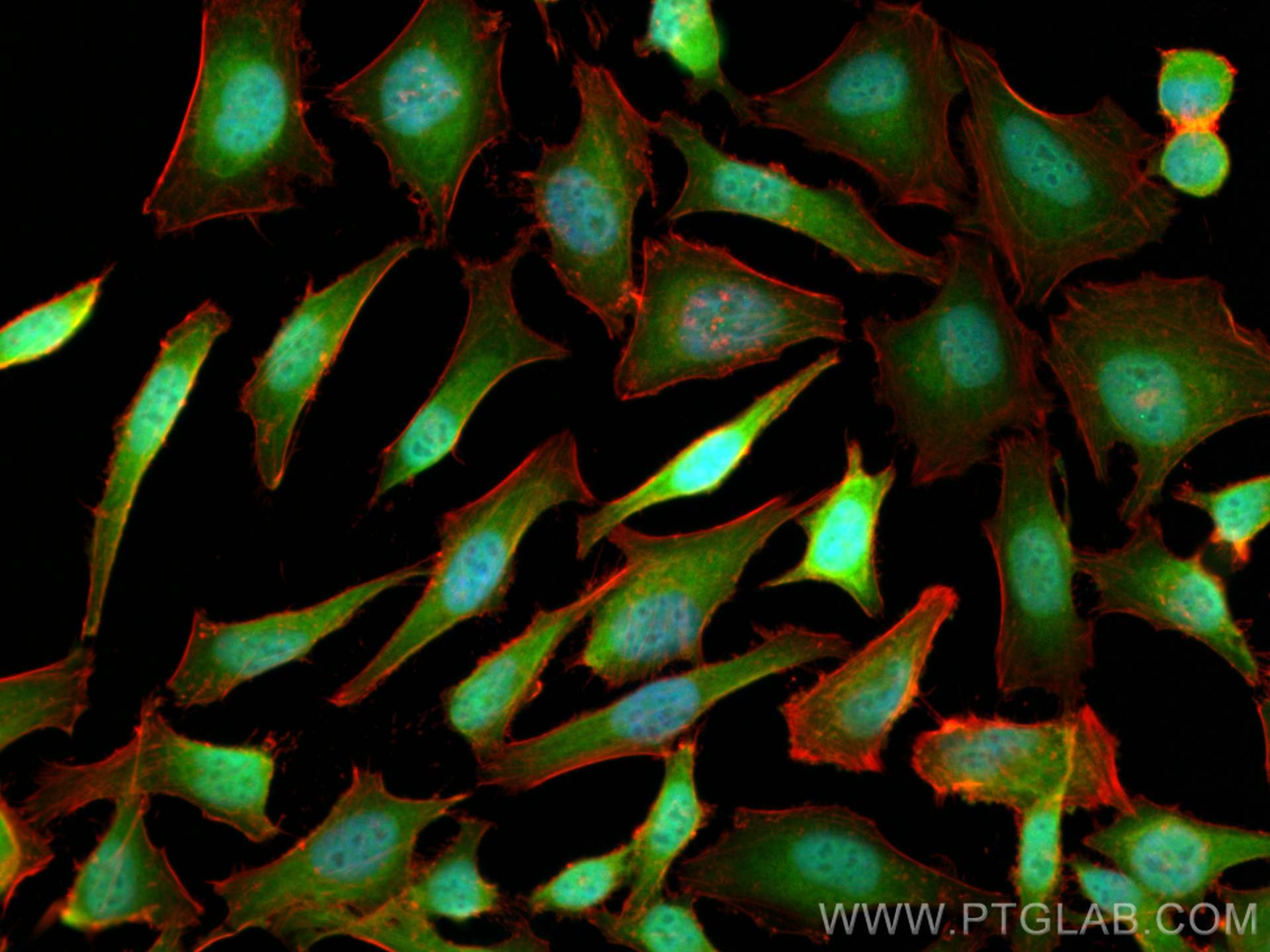 IF Staining of HeLa using 13174-1-AP