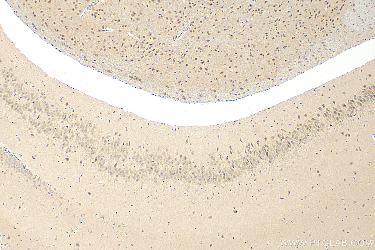 IHC staining of mouse brain using 13174-1-AP