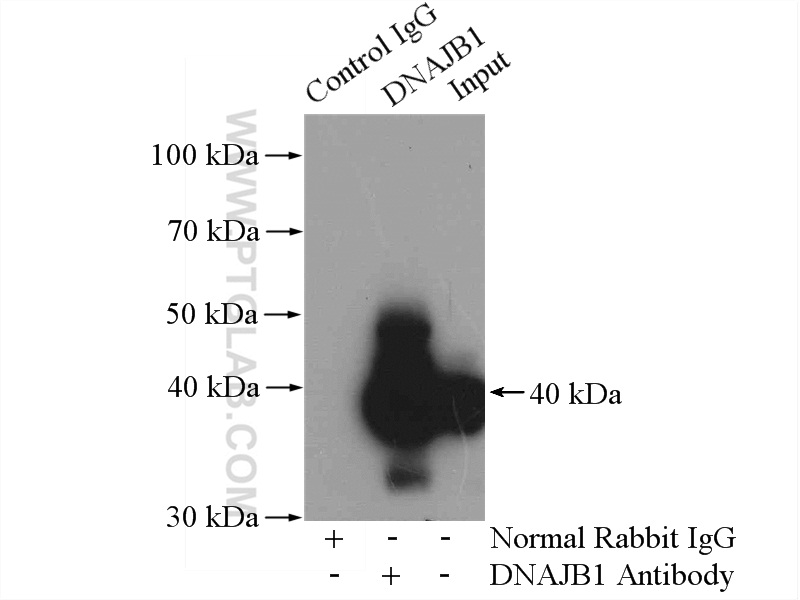 IP experiment of mouse lung using 13174-1-AP