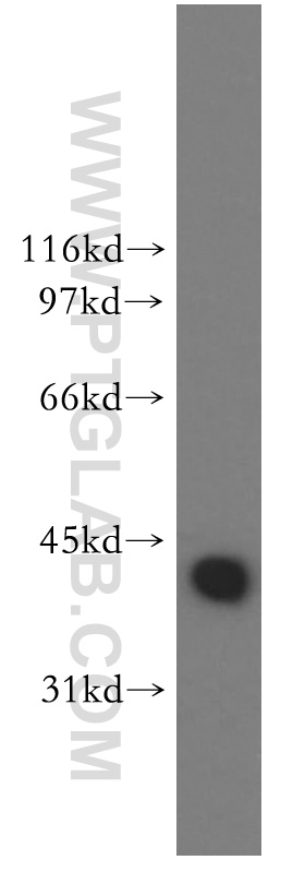 DNAJB1 Polyclonal antibody