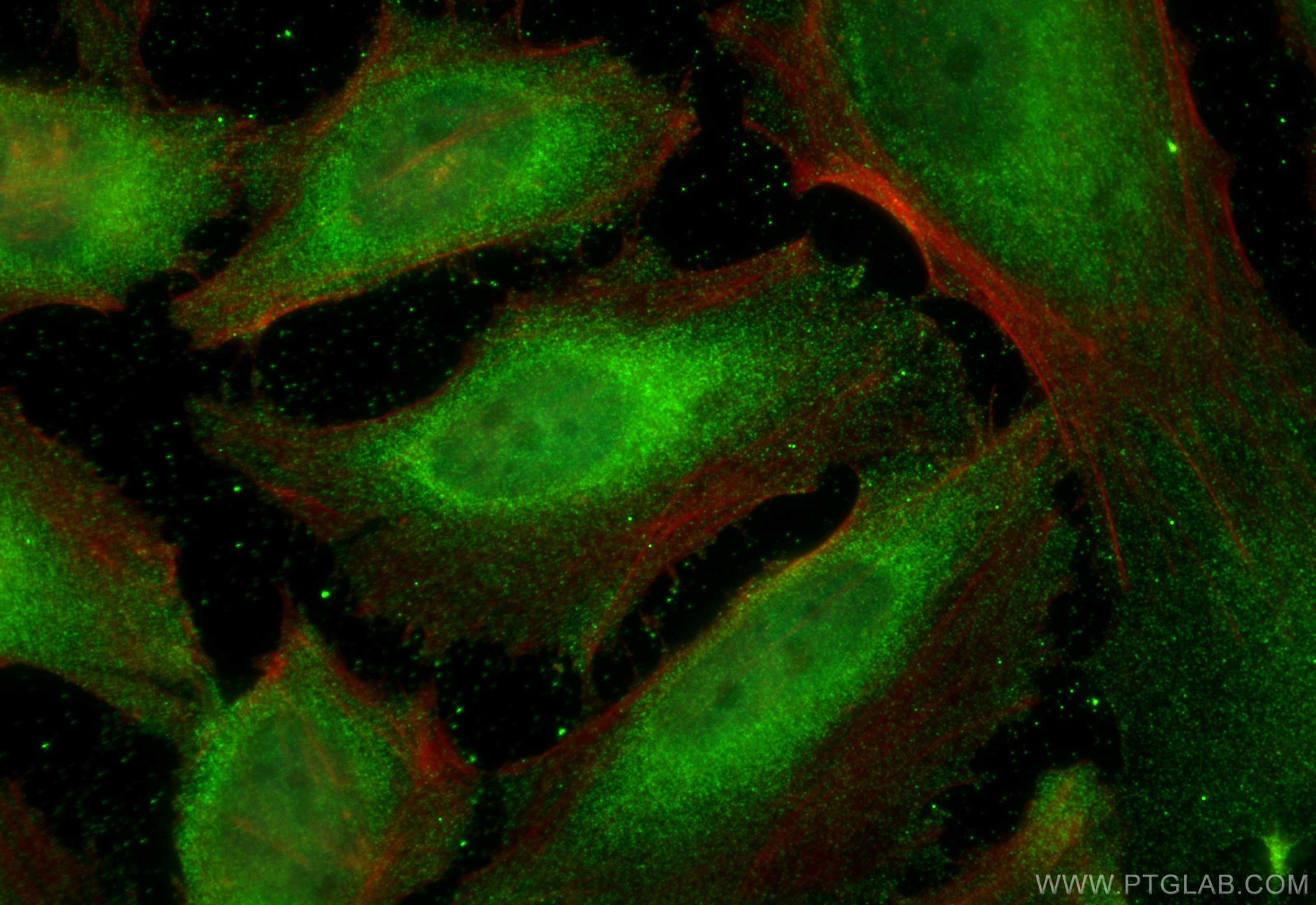 IF Staining of HeLa using 67422-1-Ig (same clone as 67422-1-PBS)
