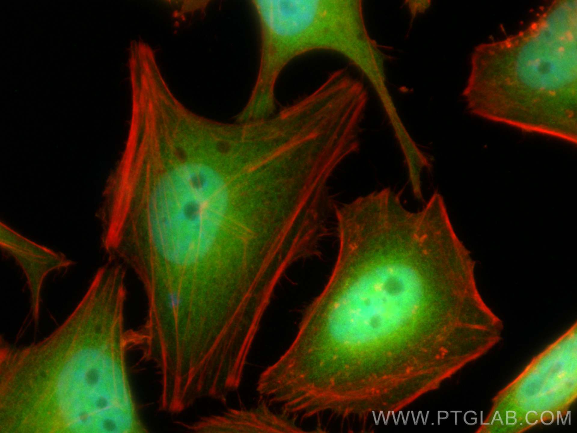 IF Staining of HeLa using 82676-1-RR (same clone as 82676-1-PBS)