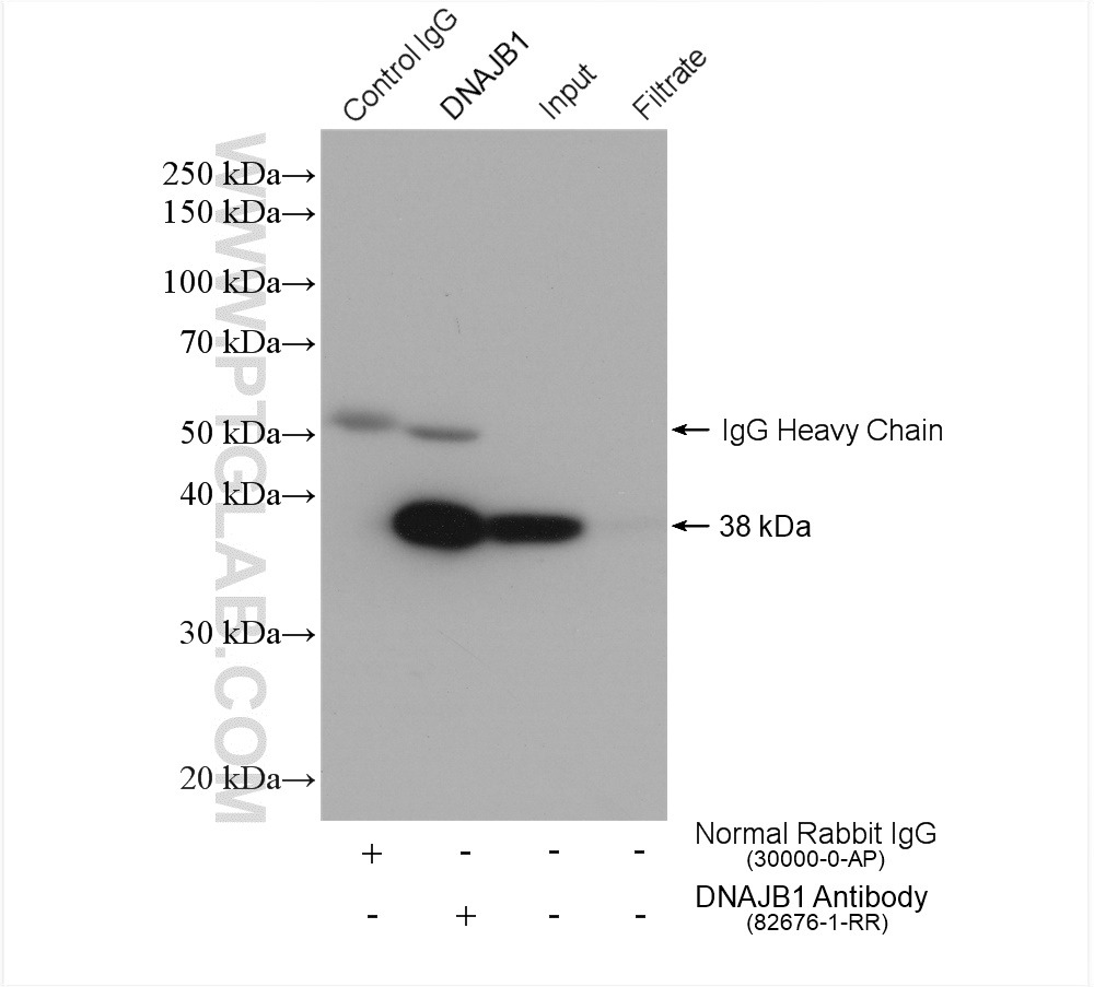 IP experiment of mouse lung using 82676-1-RR