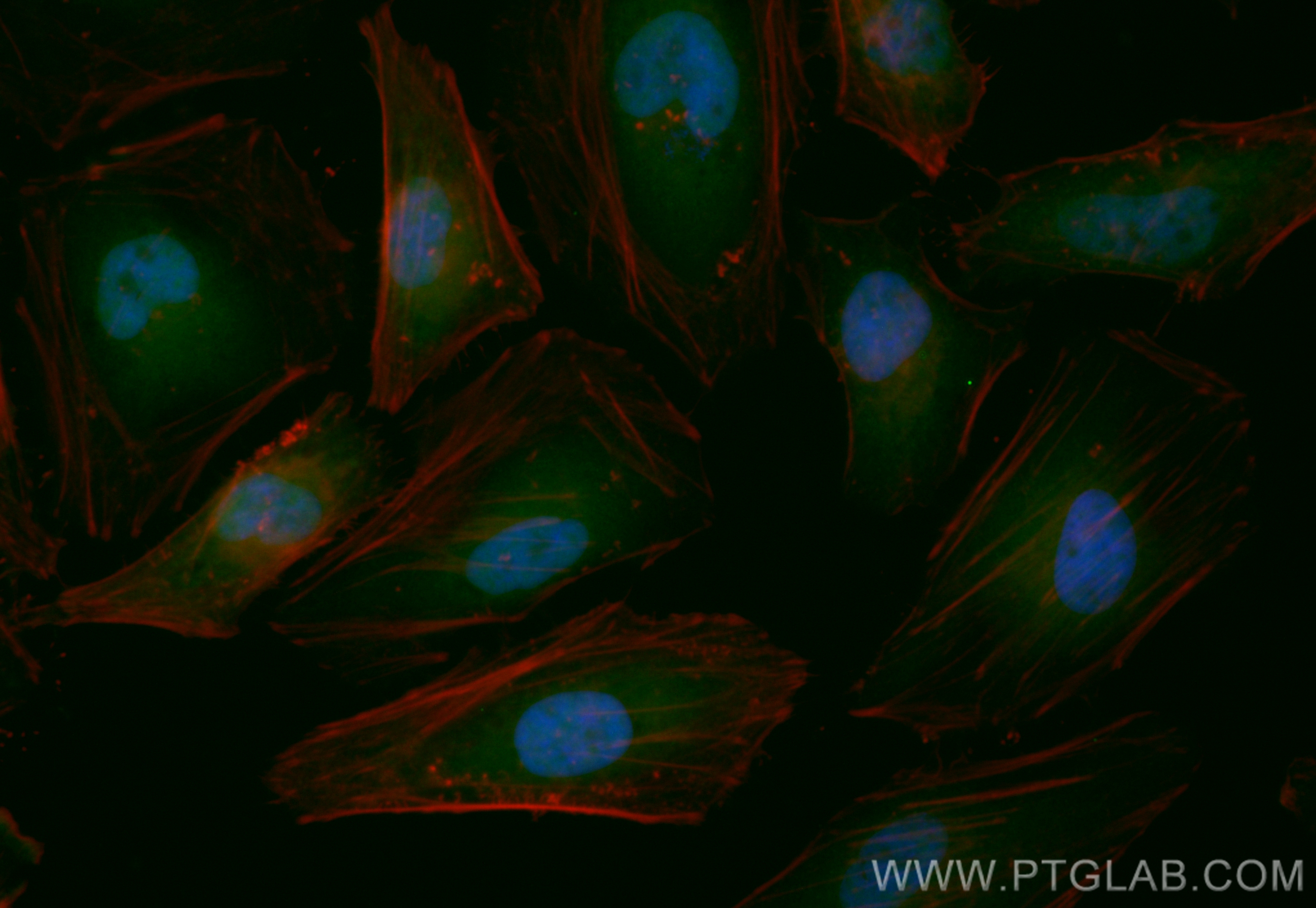IF Staining of HeLa using CL488-13174