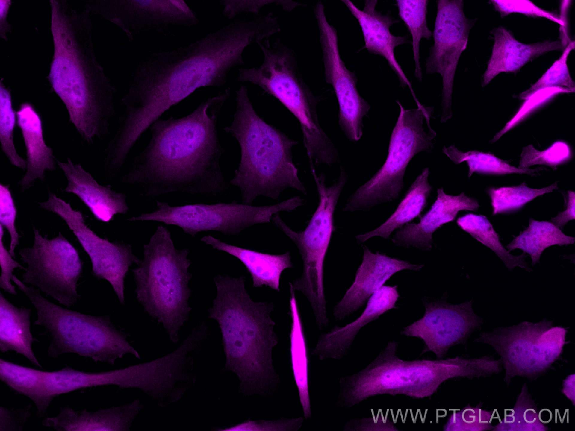 IF Staining of HeLa using CL647-13174