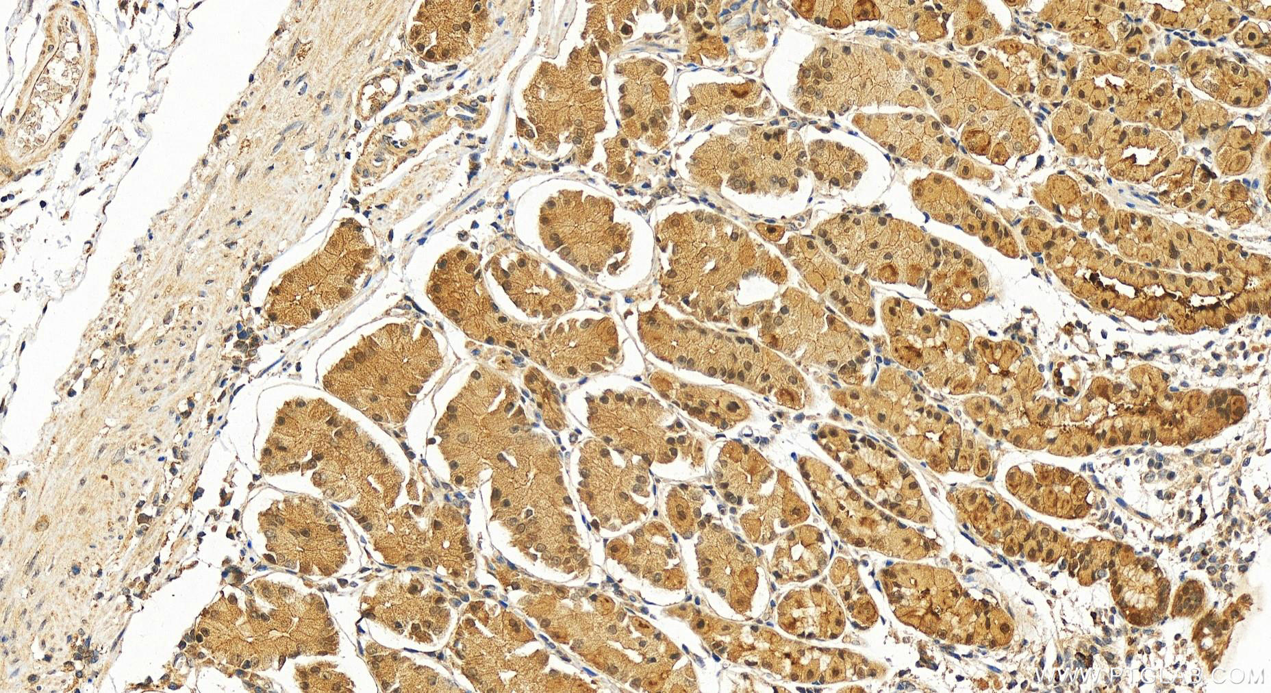 IHC staining of human stomach using 10838-1-AP