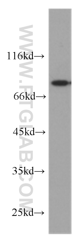 WB analysis of SH-SY5Y using 60204-1-Ig
