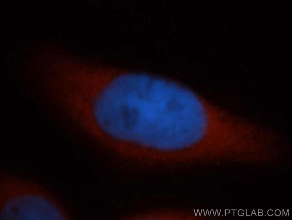 IF Staining of MCF-7 using 13064-1-AP