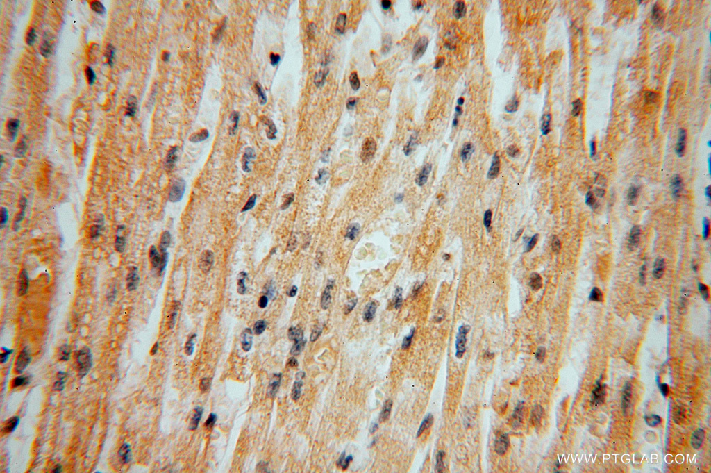 IHC staining of human heart using 16453-1-AP