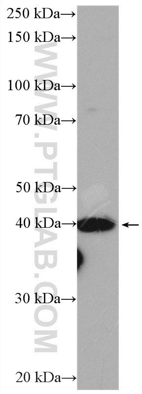 WB analysis of rat heart using 16453-1-AP