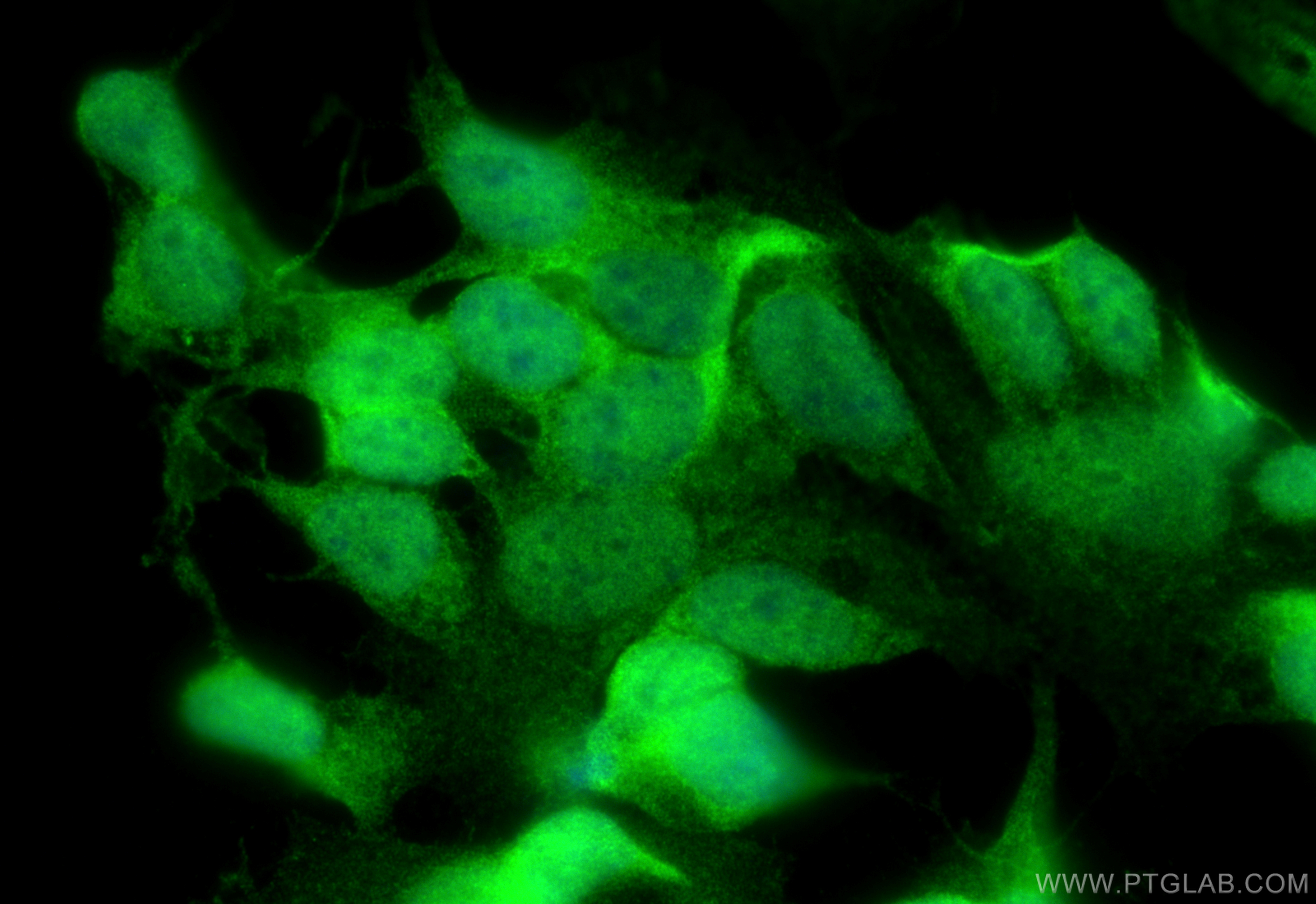 IF Staining of SH-SY5Y using 11707-1-AP